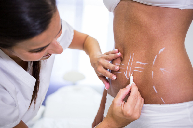 Lipo HD amplia possibilidades da defini&ccedil;&atilde;o corporal