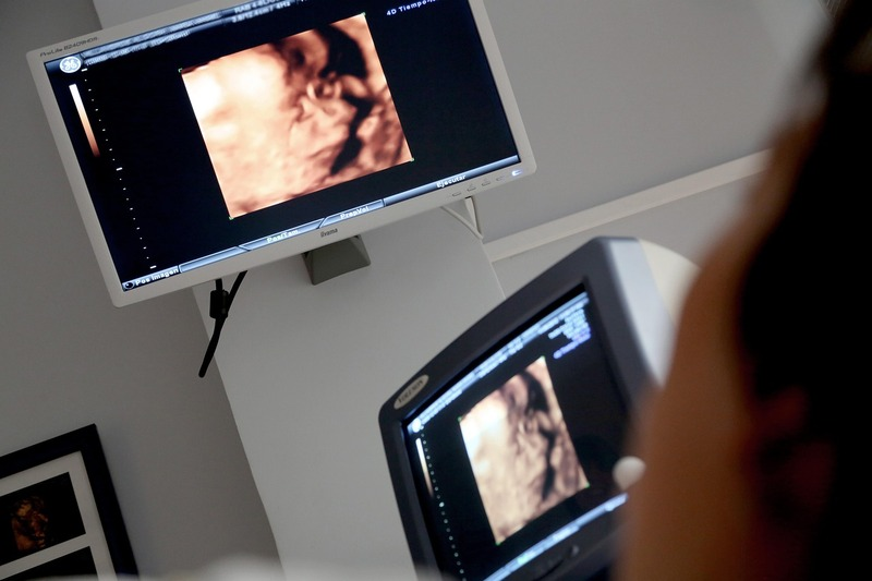 Pesquisa refor&ccedil;a t&eacute;cnica fetal para h&eacute;rnia diafragm&aacute;tica